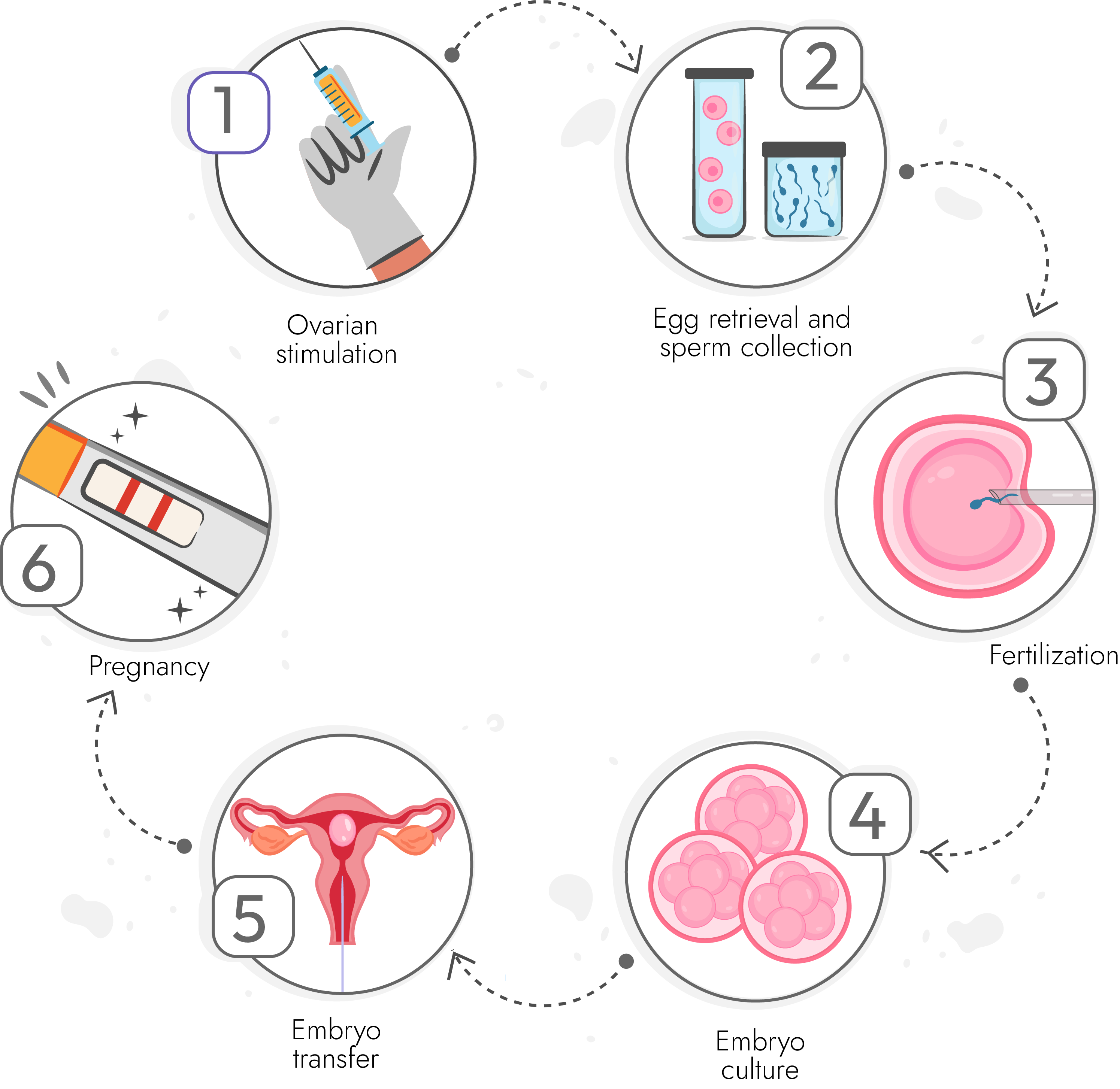 IVF Process